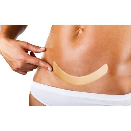 Lâmina Skin Abdominal 39x5cm - Ortho Pauher