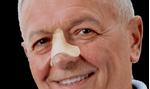 Lamina-Skin-Nasal---Ortho-Pauher--1-