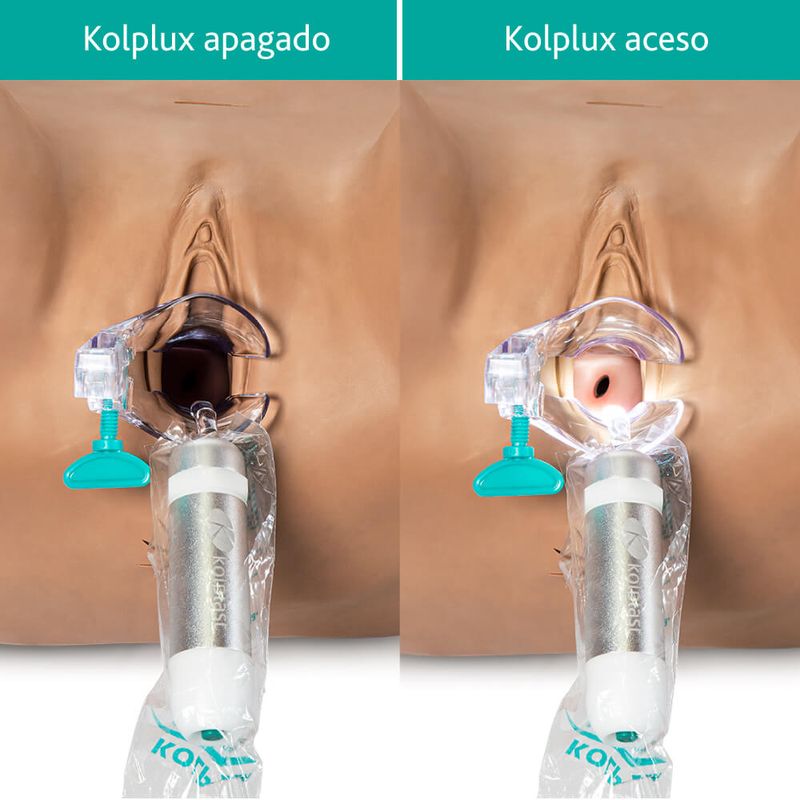 Comparativo-especulo-Kolplux